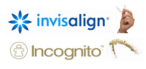 Invisalign