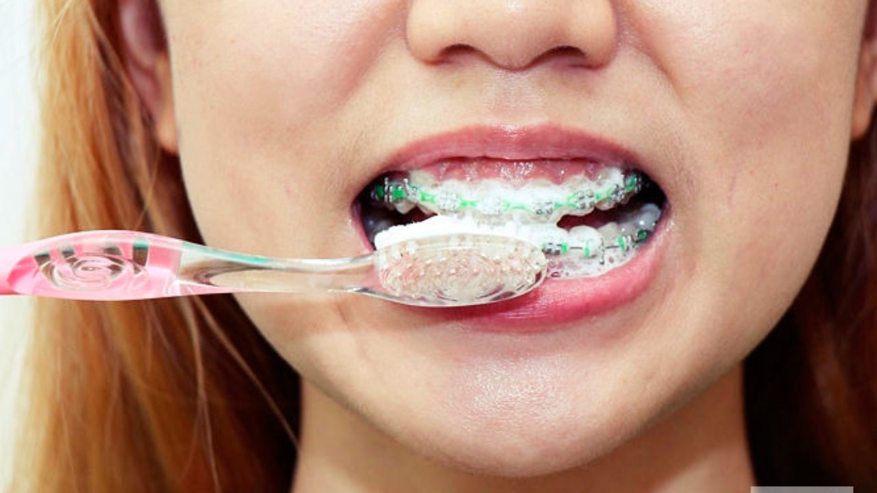 Что кушать после чистки зубов