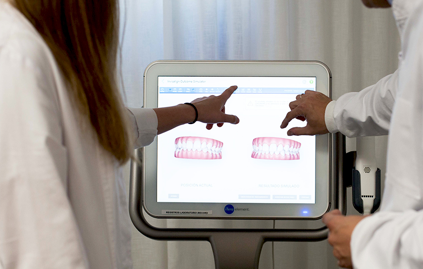 Conoce a iTero, el escáner 3D del tratamiento Invisalign. Novasmile