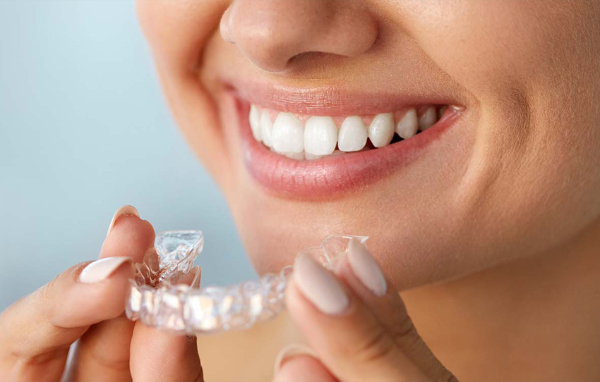 Mejorar tu sonrisa sin que nadie lo note ya es posible con Invisalign