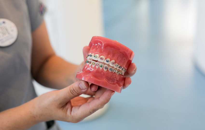 ¿Qué tipo de ortodoncia es la más indicada para mi? Novasmile.