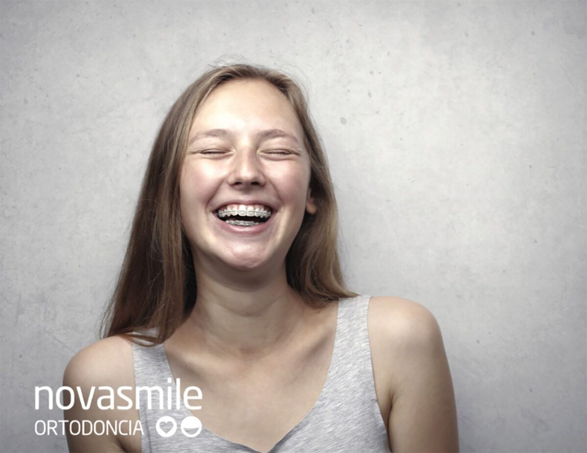 Hablar con Brackets - Ortodoncia NovaSmile