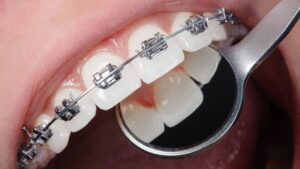 urgencias ortodoncia