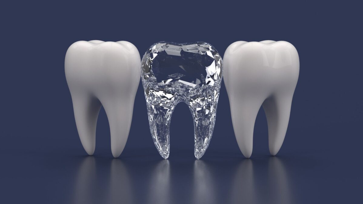 joyas dentales